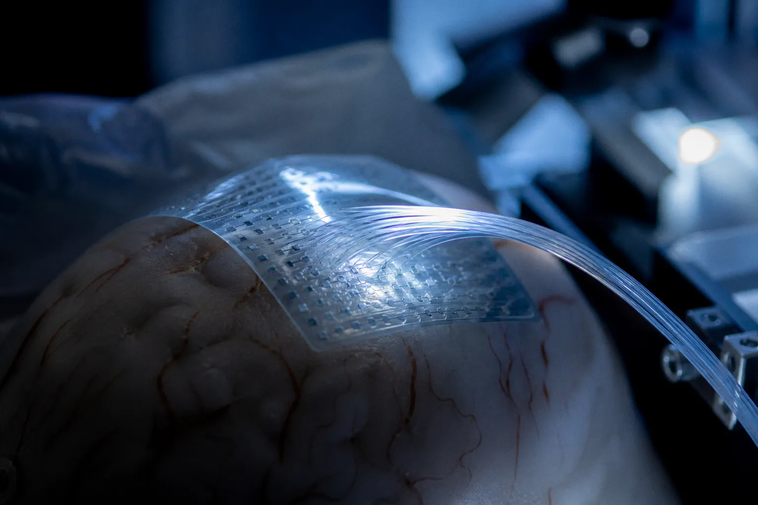 What is a brain-computer interface? A neural signal's journey